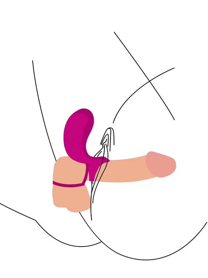 Couples Stimulator Ring - Vibrating cock ring 2